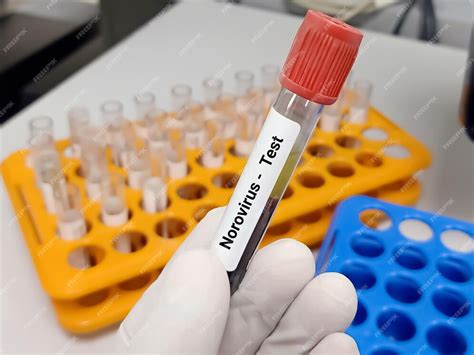 Premium Photo Test Tube With Blood Sample For Norovirus Test A