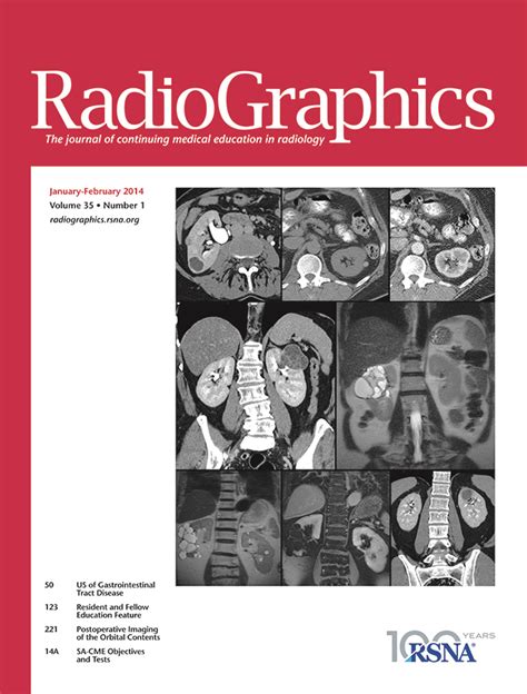 Hematologic Malignancies Of The Liver Spectrum Of Disease Radiographics