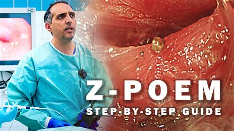 Zenkers Diverticulum Nejm