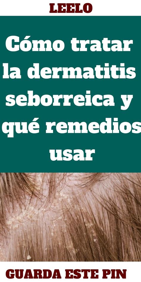 Cómo tratar la dermatitis seborreica y qué remedios usar Lockscreen