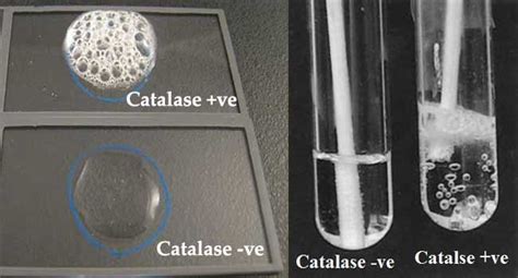 Catalase Test Principle Uses Procedure Result Interpretation With Precautions This Test