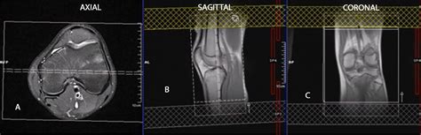 Knee MRI RadTechOnDuty