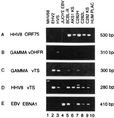 Evidence For A Vts Gene In Human Bcbl Dna As Detected By The Redundant