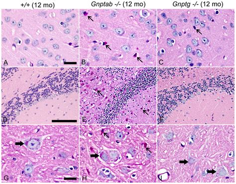 Cns Tissue Stained By The Periodic Acid Schiff Method A The Cns Of