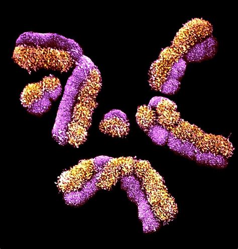 Human Chromosomes Sem Photograph By Science Photo Library