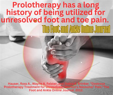 Foot Pain Treatment Peter A Fields Md Dc