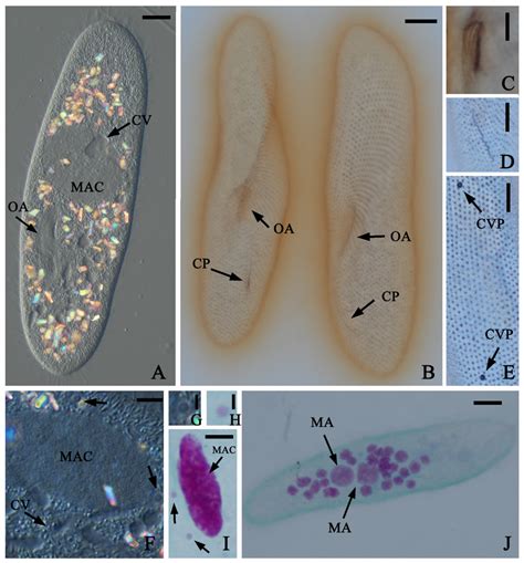 Paramecium Aurelia And Paramecium Caudatum