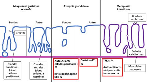 JLE Hépato Gastro Oncologie Digestive Biomarqueurs sanguins des