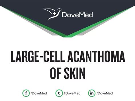 Large-Cell Acanthoma of Skin - DoveMed