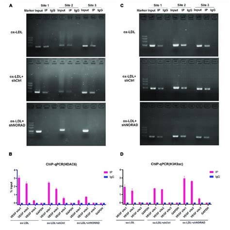 Knockdown Of LncRNA NORAD Attenuates Ox LDL Induced Vascular