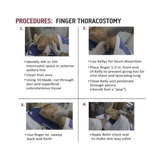 Chest Tube Flashcards Quizlet