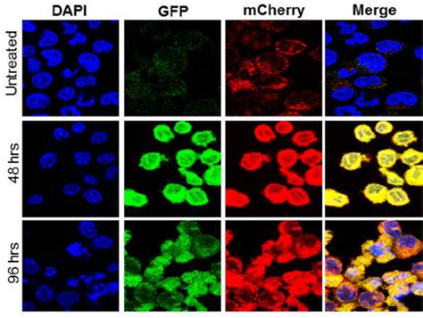 Oci Aml3 Cells Transduced With Lc3 Gfp Mcherry Construct Were Treated