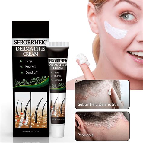 1pcs Seborrheic Dermatitis Cream Scalp Treatment Cream Rapid