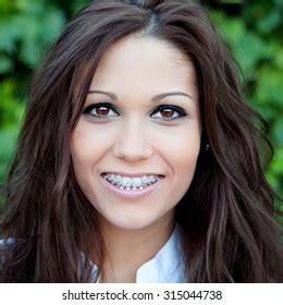 1 193 A Beautiful Brunette Girl With Brackets Images Stock Photos