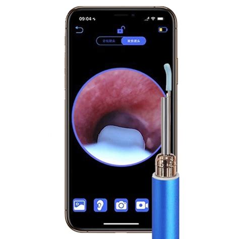 Smart Wireless Visual Ear Camera WiFi HD Ear Scope Otoscope Endoscope