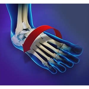 Ankle Instability Surgery Dallas TX | Ankle Replacement Dallas TX