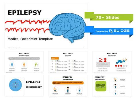 Download Epilepsy Powerpoint Template Rxslides