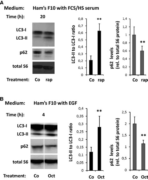 Western Blot Analysis Of Lc I To Lc Ii Conversion And Of Sqstm P