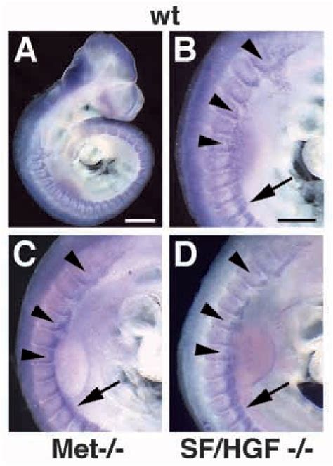 Figure From The Role Of Sf Hgf And C Met In The Development Of