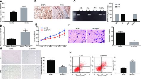 Overexpression Of Sfrp Suppressed Proliferation And Enhanced Apoptosis