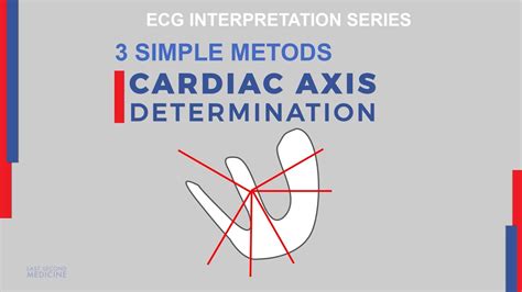 Understand Cardiac Axis How To Calculate On Ecg Background