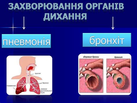 Захворювання органів дихання - презентация онлайн