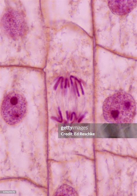 Anaphase Plant Mitosis Onion Root Tip 400x High Res Stock Photo Getty