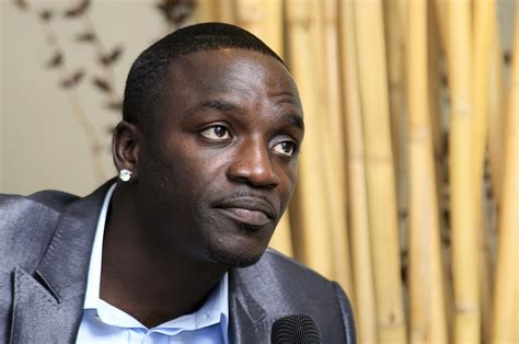 World Famous Singer Akon Gets Hair Transplant In Türkiye Daily Sabah