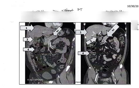 Organs Coronal Section Diagram Quizlet