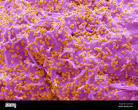 Hiv Infected T Cell Coloured Scanning Electron Micrograph Sem Of