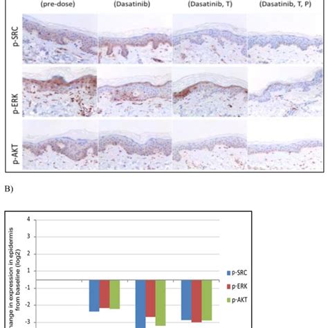 Immunohistochemical Expression Analysis Of P Src Pakt P Erk Protein Download Scientific