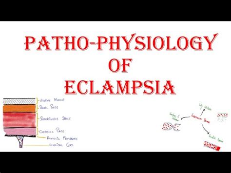 PATHOPHYSIOLOGY OF ECLAMPSIA - YouTube