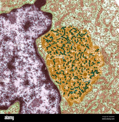 Hybridoma Cell Coloured Transmission Electron Micrograph Tem This