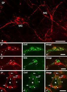 Localization Of Substance P SP Immunoreactivity In The Myenteric