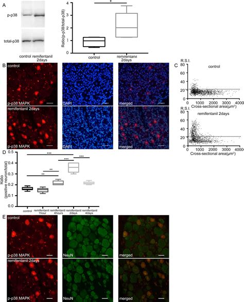 Spinal And Peripheral Mechanisms Individually Lead To The Development