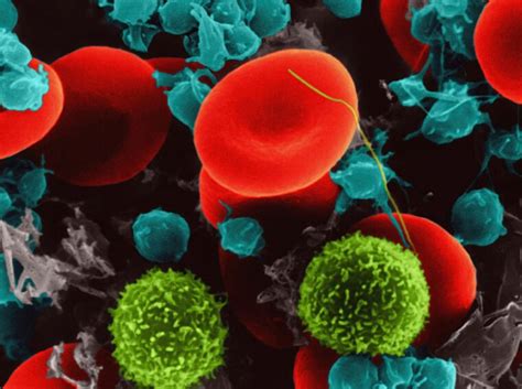 Interpreting Lymphocyte and Neutrophil Counts: The Implications of Low Lymphocytes High ...