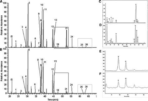 GC MS Total Ion Chromatograms TIC Of LC FAs In Retina And RPE Choroid