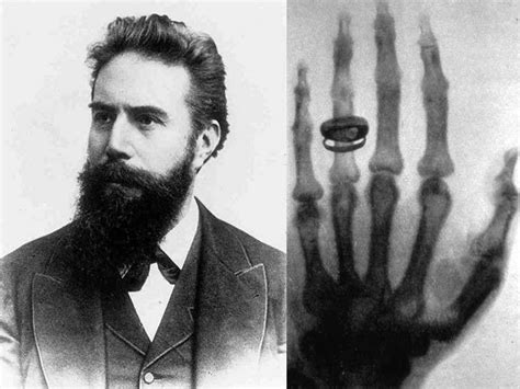 Come avvenne la scoperta dei raggi X Wilhelm Röntgen raggix fisica