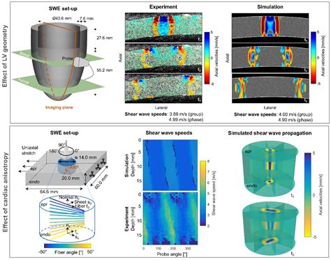 Cardiac And Arterial Shear Wave Elastography Institute Of Biomedical