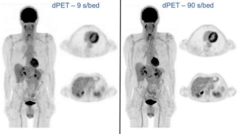 Precision Nuclear Medicine Radiology Key