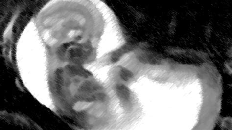 Ultrasound Pad Pianobook