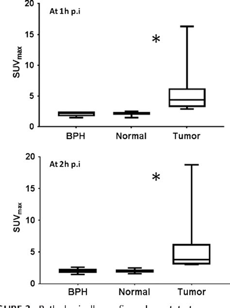 Figure 3 From Prostate Specific Membrane Antigen Targeted Pet Ct