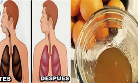 LIMPIA LOS PULMONES DE FLEMAS NICOTINA Y ALQUITRAN FACILMENTE CON ESTE