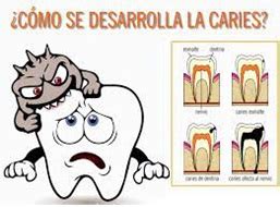 C Mo Prevenir La Caries Dental Custom Dental