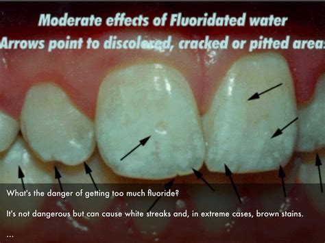 Fluoride By Haley Gross