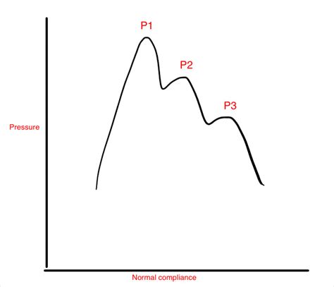 Figure Intracranial Pressure Waveform Showing Normal Statpearls