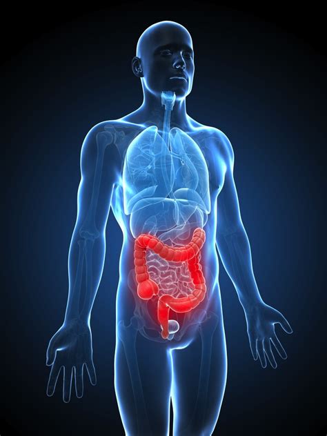 Inflammatory Bowel Disease