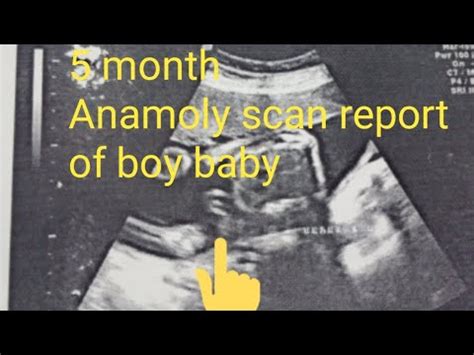 Month Anomaly Scan Report Of Boy Baby Youtube