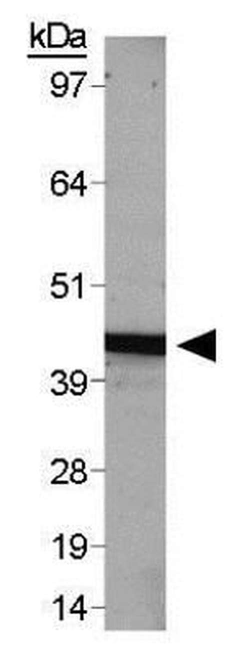Beta Actin Antibody Pa1 32416
