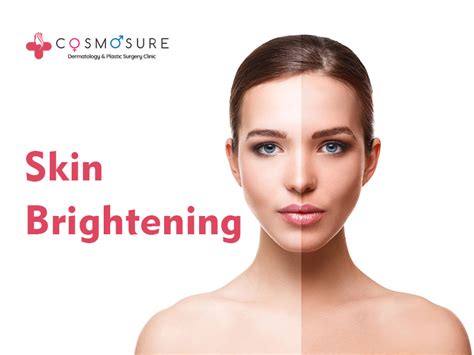 Skin Brightening | Cosmosure Clinic